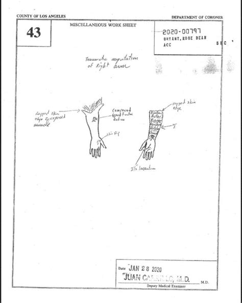 gigi.bryant autopsy|Autopsies show Bryant, other passengers died。